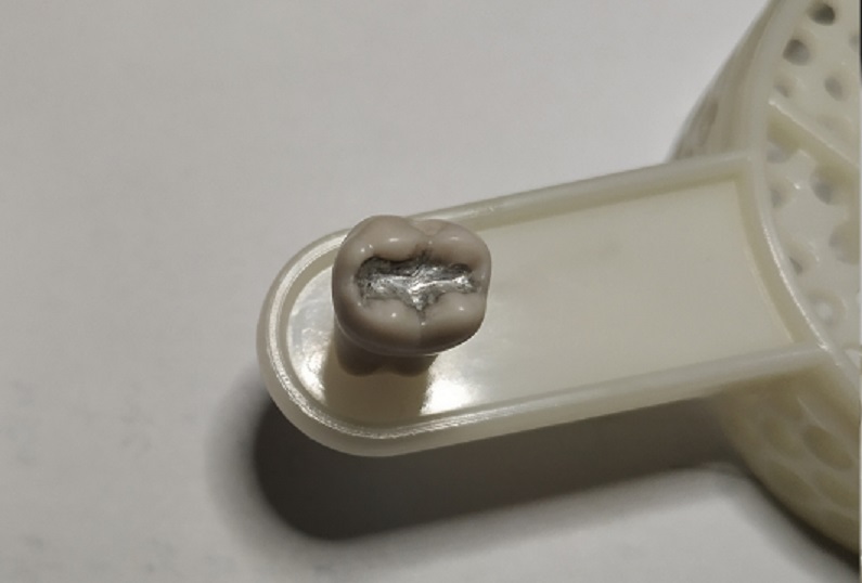 牙体实验课——银汞补牙术